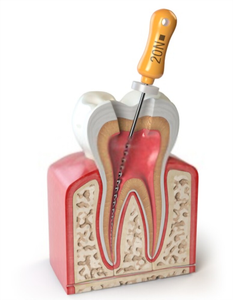 Endodontia