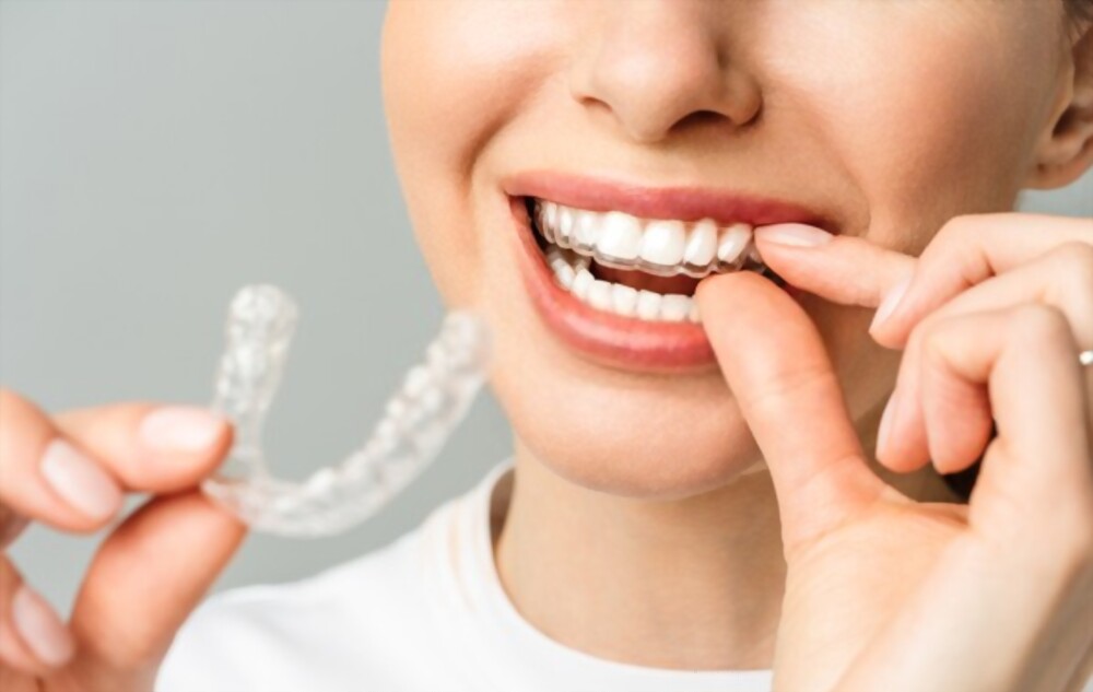 Invisalign